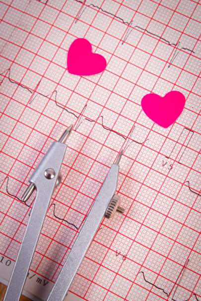 hearts-of-paper-and-calipers-on-electrocardiogram-2021-08-26-18-16-11-utc
